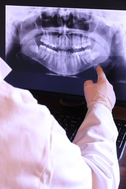 Best Emergency Root Canal Treatment in El Cerrito, CA