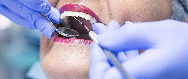 Best Weekend Emergency Dentist in El Cerrito, CA